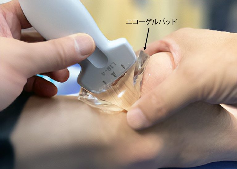エコーゲルパッド 八十島プロシード株式会社